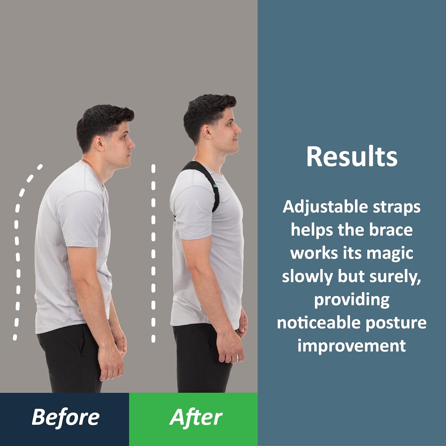 Advanced Posture Correction System